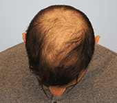 img2