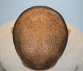 img3